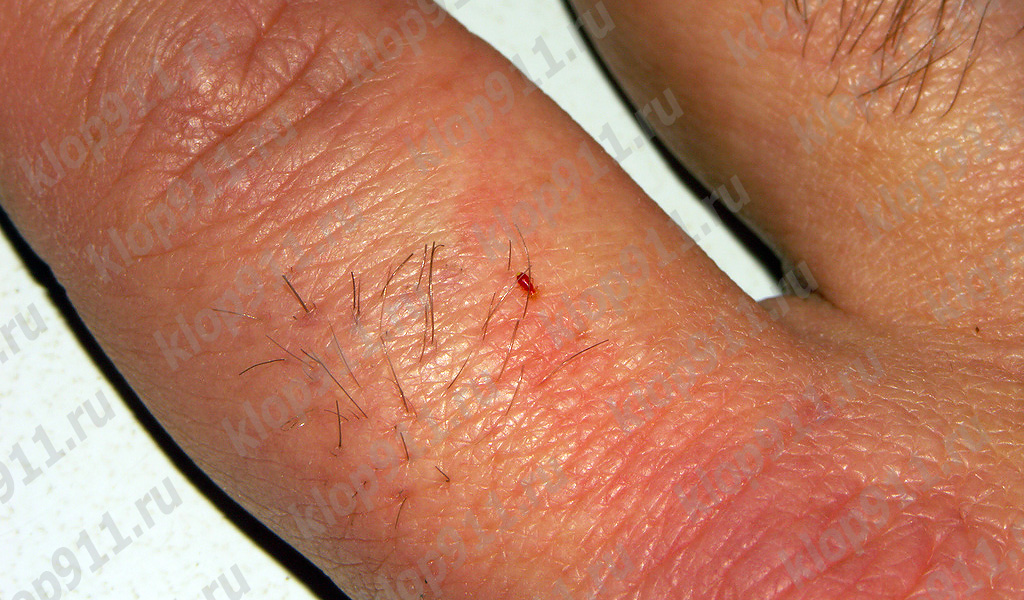 La larva bebe sangre